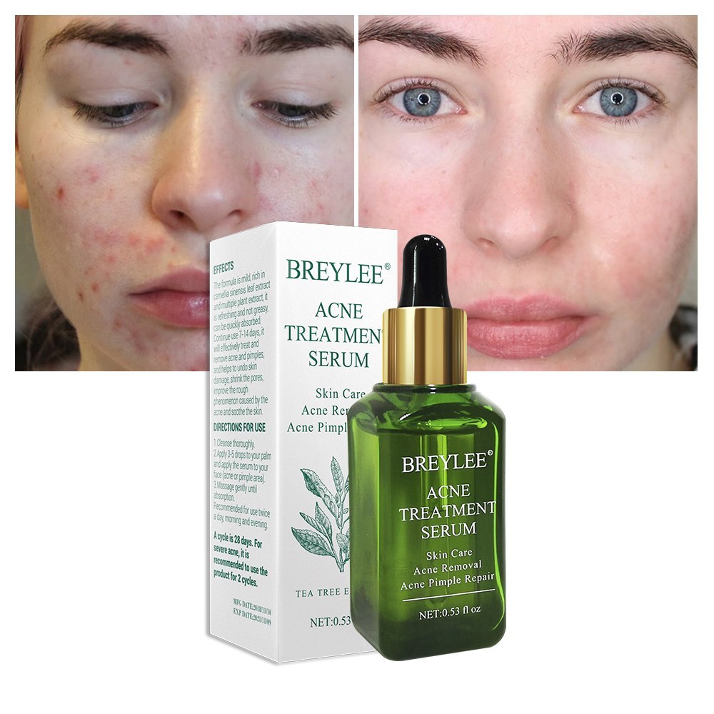 Face Cream